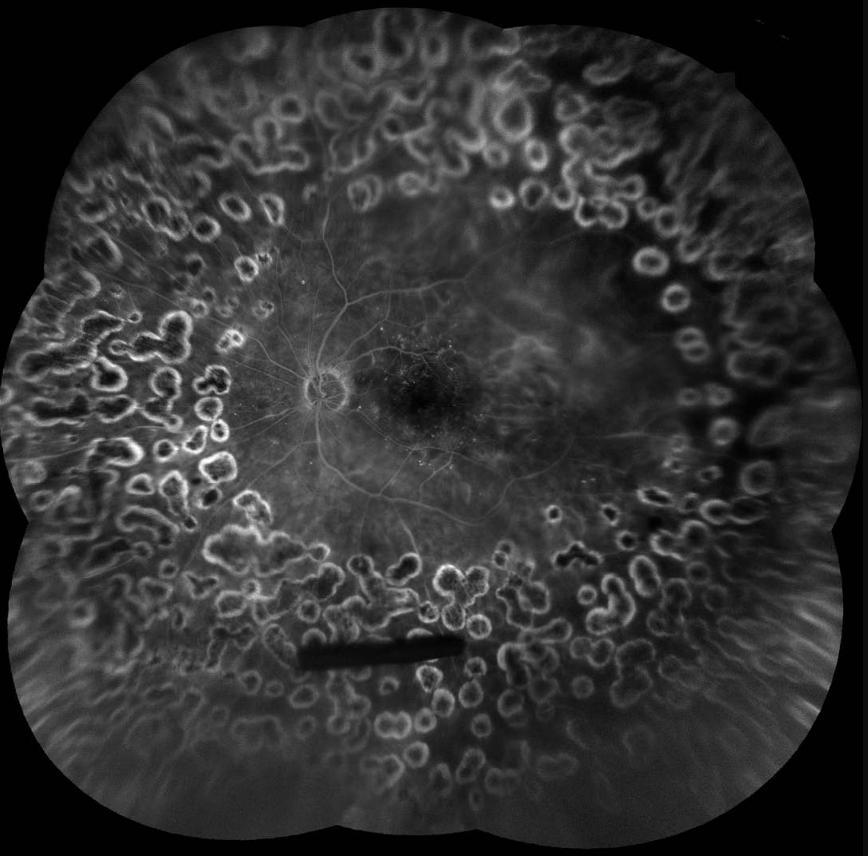 iCare EIDON FA snímek 1