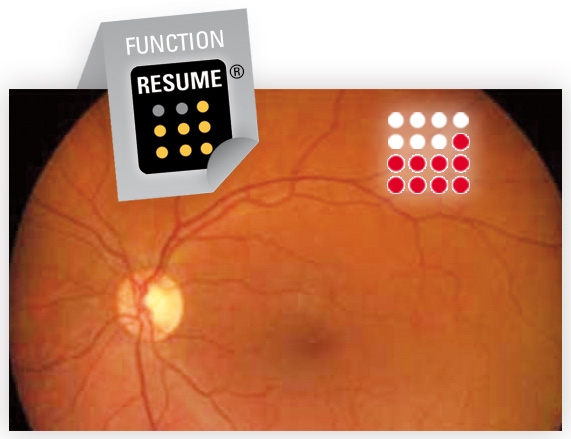 Quantel Medical EasyRet Resume mód