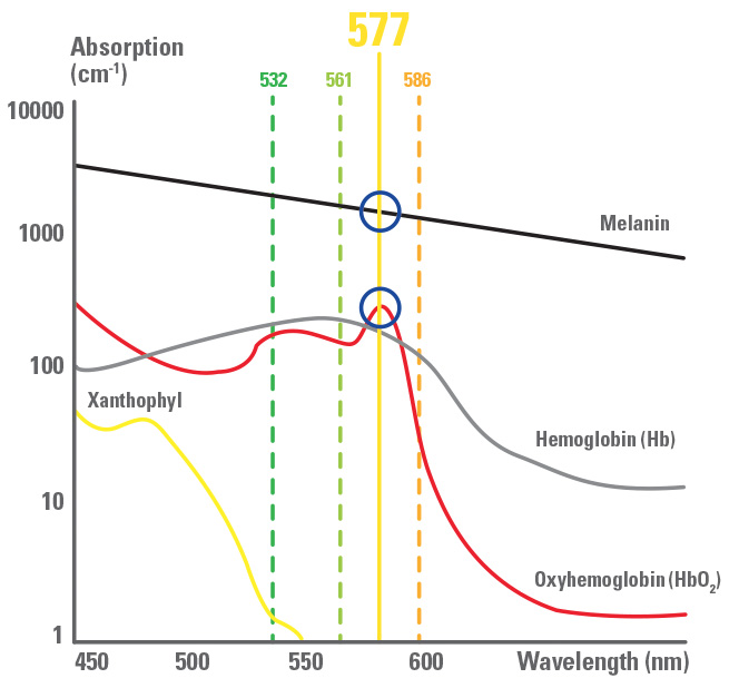 Quantel Medical EasyRet graf