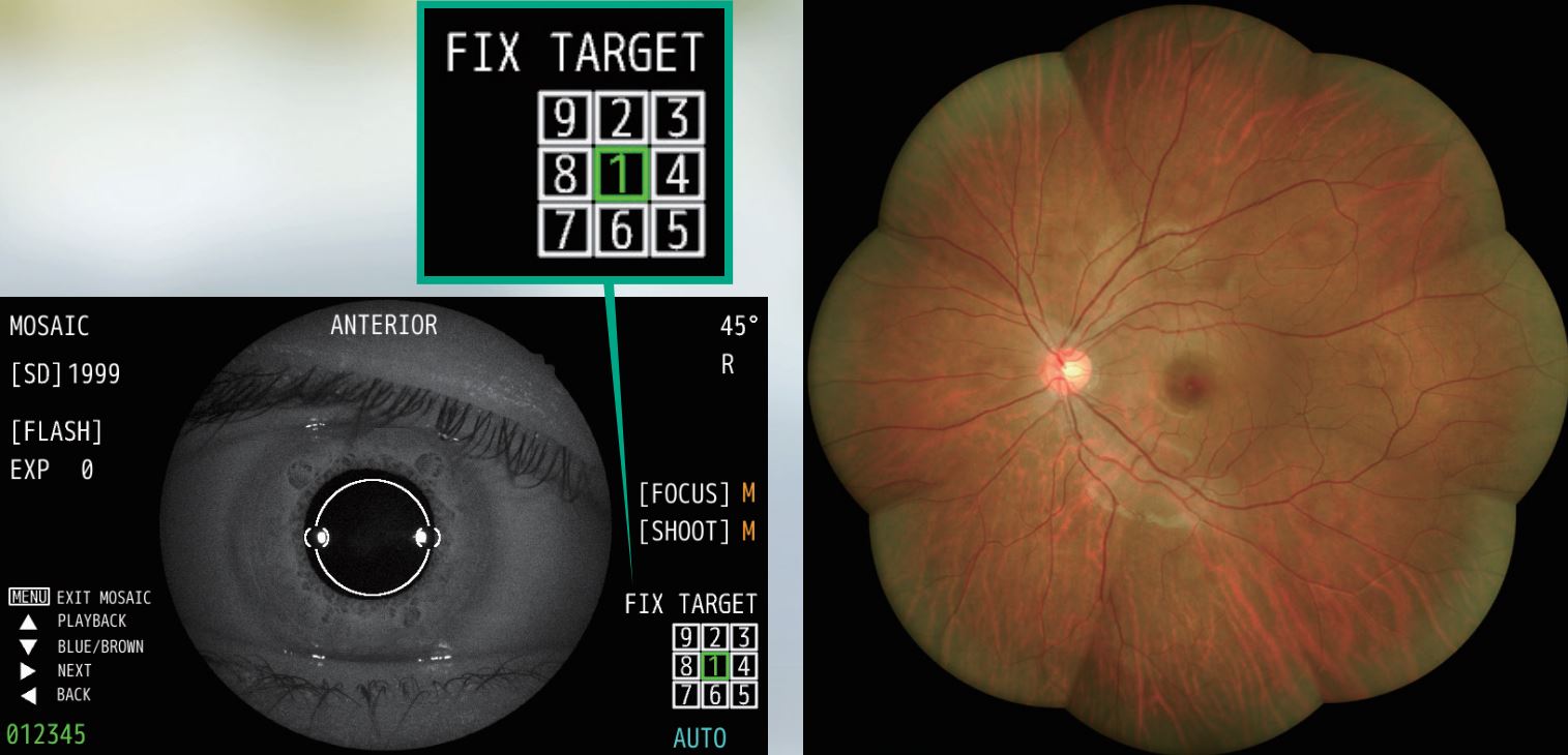 Kowa nonmyd AF mozaika