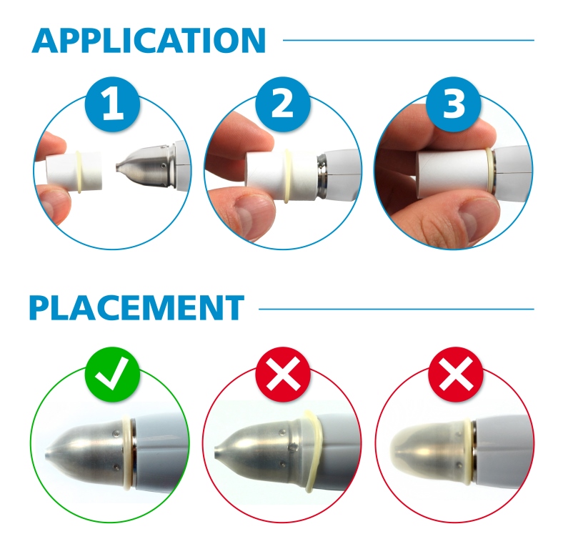 Keeler AccuPen aplikace AccuTip