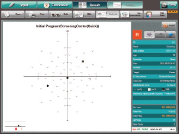 Kowa AP-7000 ukázka rozhraní