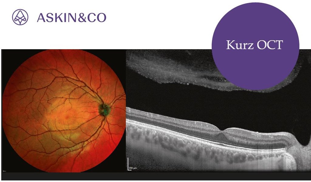 Kurz OCT Askin & Co. s.r.o. - zvětšit obrázek