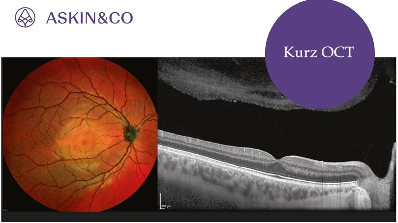 Kurz OCT Askin & Co. s.r.o.