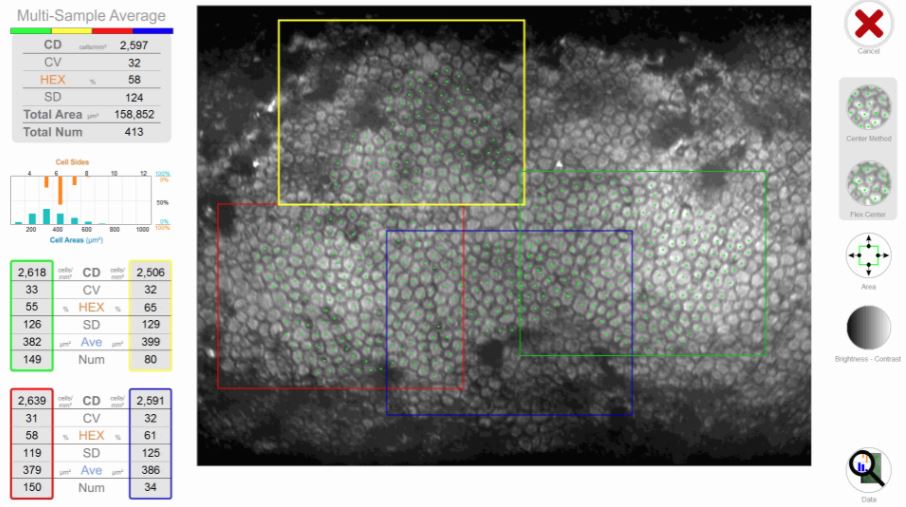 Konan CellChek D+ ukázka výstupů a analýzy 