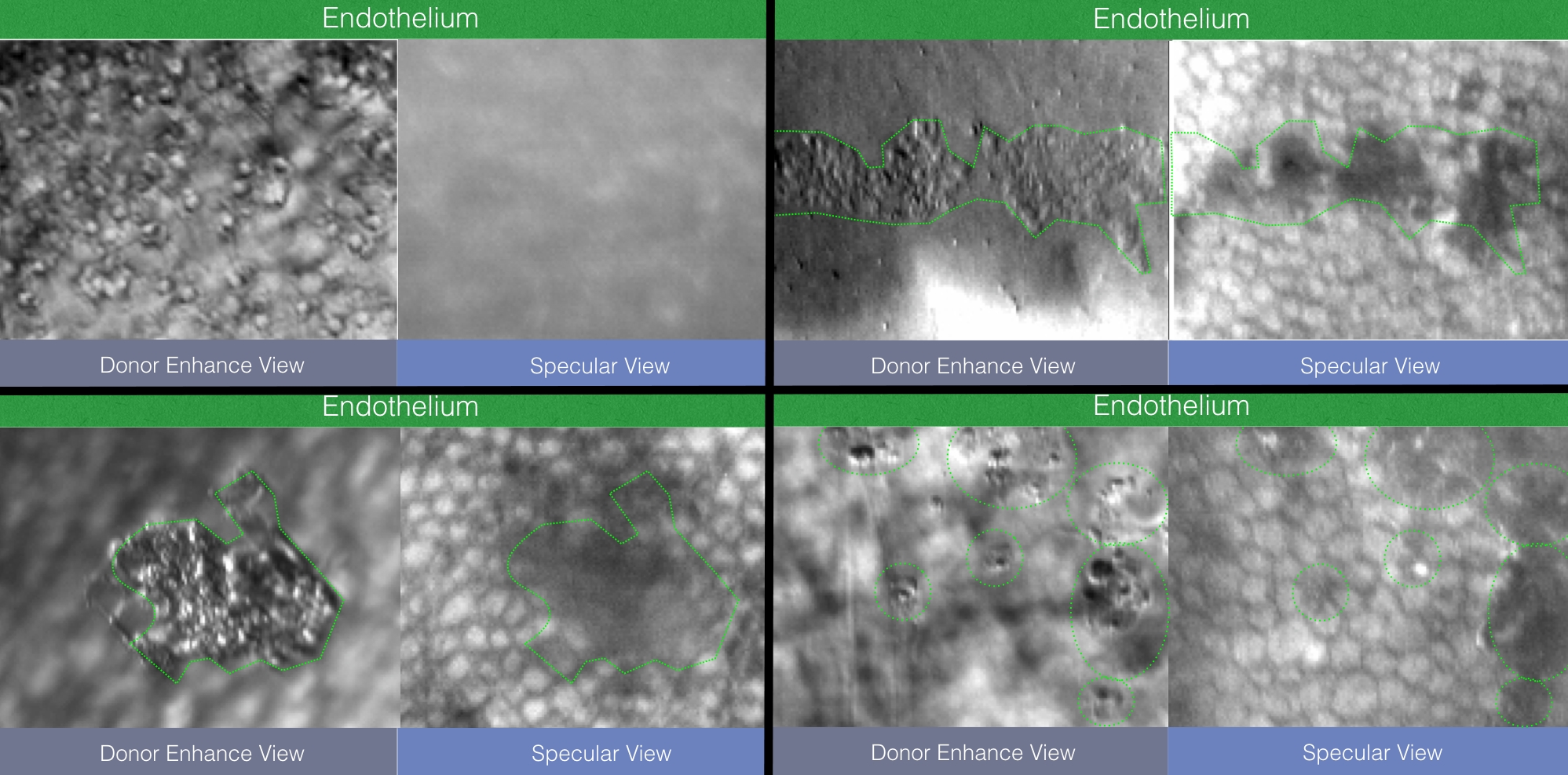 Konan CellChek D+ srovnání