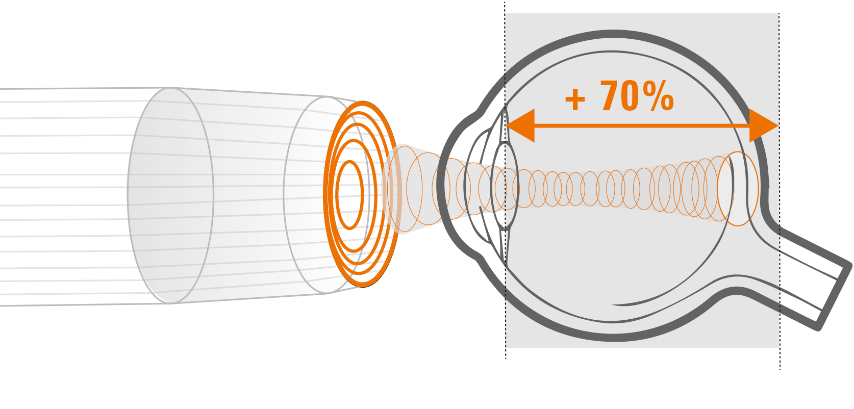 Anulární 20MHz somda