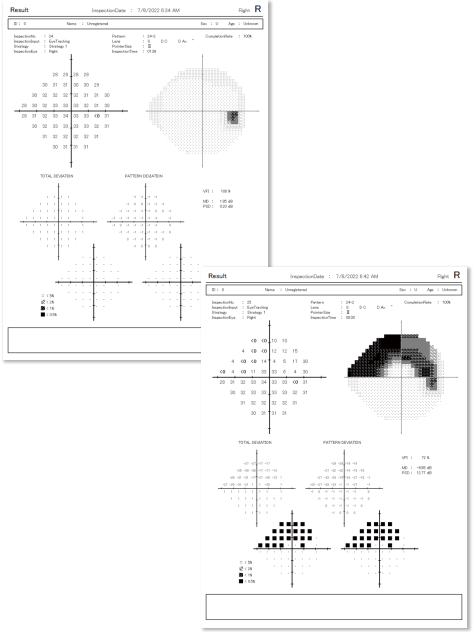 Rexxam FieldNavigator výstupy